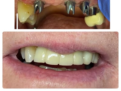 Elwood Family Dental Care