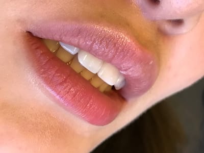 Emergency Dentist of Los Angeles-24 Hour