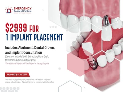 Emergency Dentist of Portland, Gresham, Happy Valley, Milwaukie