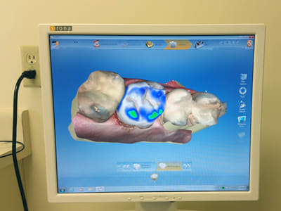 Eric Bryant Laser Dentistry