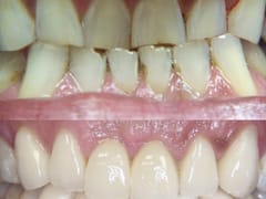 Everett Premier Dentistry: Sumit Makker D.D.S