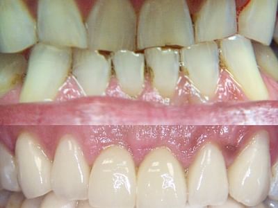 Everett Premier Dentistry: Sumit Makker D.D.S