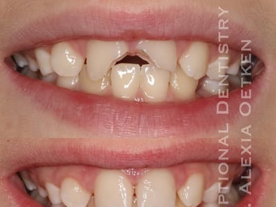 Exceptional Dentistry of the Tri-State Region