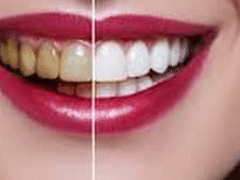 Family And Cosmetic Dentistry