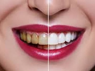 Family And Cosmetic Dentistry