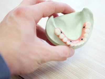 Family Dentistry Naples