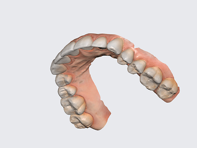 Family Dentistry - West End