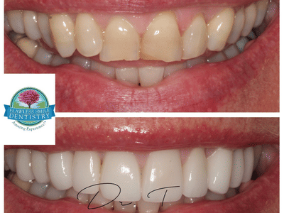 Flawless Smile Dentistry - Claremore