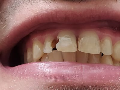 Forrest Tower, DDS - Oak Lawn Dentist