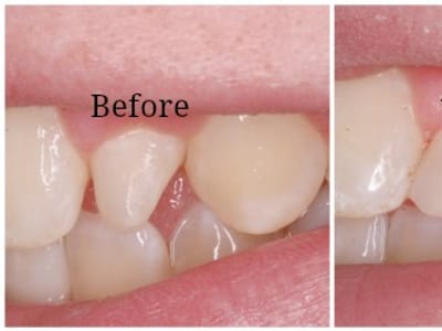 Foundations of Health Dental Care