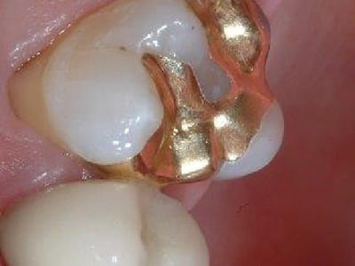 Foundations of Health Dental Care