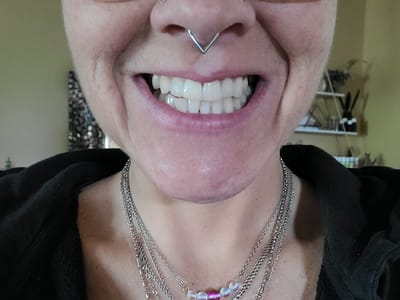 Four Corners Dental and Dentures