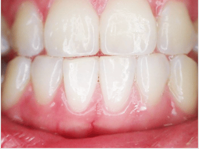 Franklin Dental Center in Tyler