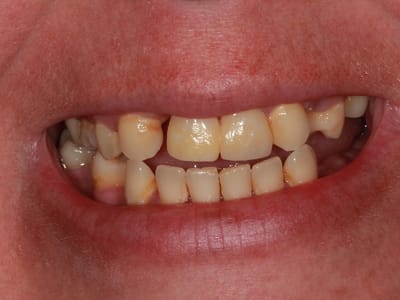 Frontier Family Dental