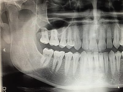 Full Smile Family Dentist