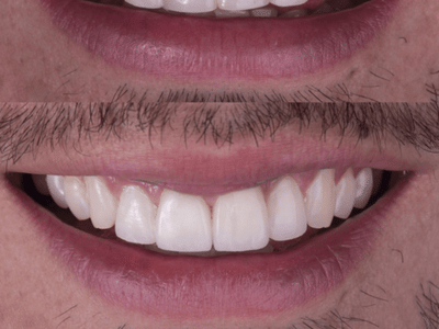 Fuller Smiles - Dentist - Rancho Cucamonga