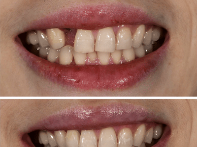 Fuller Smiles - Dentist - Rialto