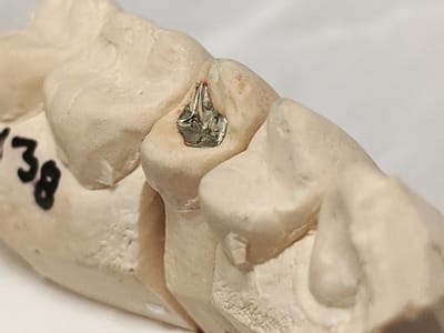 G Smile Care - Dentist in Monrovia Ca