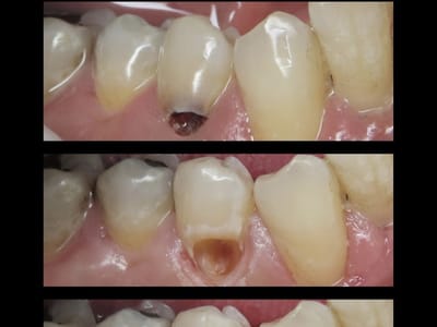 Gables Exceptional Dentistry