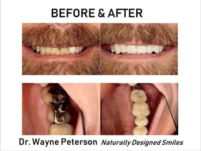 Gem State Dental (Formerly: Wayne Peterson, DMD)