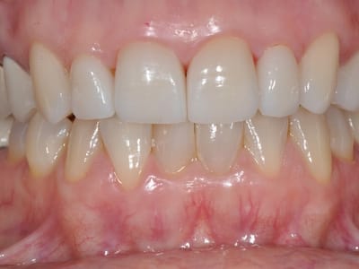 General & Cosmetic Dentistry: Dr. Kaszuba DDS