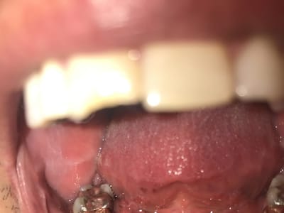 Gentle Dental Broadway