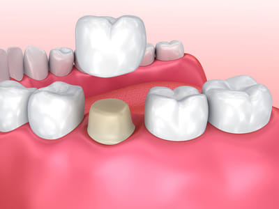 Gentle Dental Care Queens | Dentist 11418