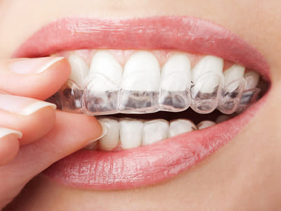 Gentle Dental Care Queens | Dentist 11418