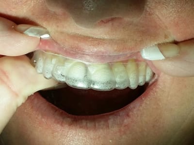 Gentle Dental Family Dentistry