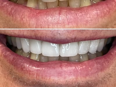 Germantown Advanced Dentistry