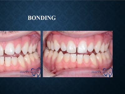 Gladstone Missouri Family Dentistry: Happy Rock Dental