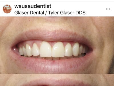 Glaser Dental