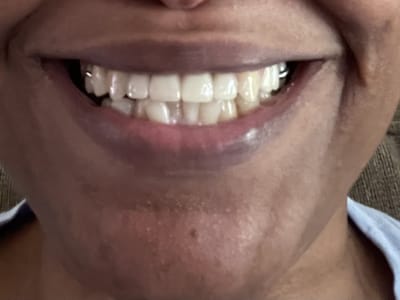 Globus Dental Springfield MA- Emergency Dentist-Root Canals- Dental office near me- Implants-Teeth Whitening