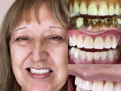 Gonzalez Dental Care - Dentist Pembroke Pines