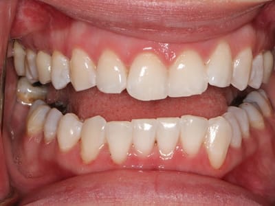 Gorgeous Smile - Arlington Cosmetic Dentist