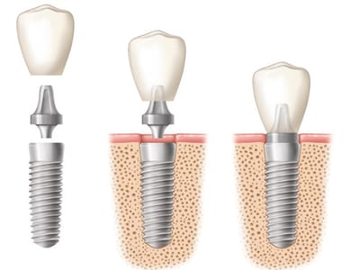 Grand Avenue Family Dental