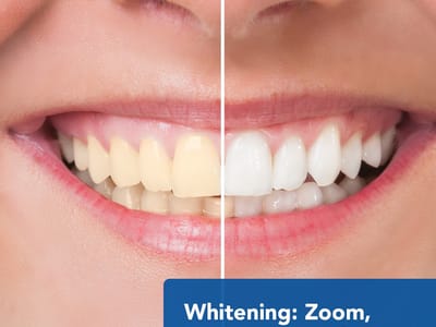 Great Expressions Dental Centers - Dublin