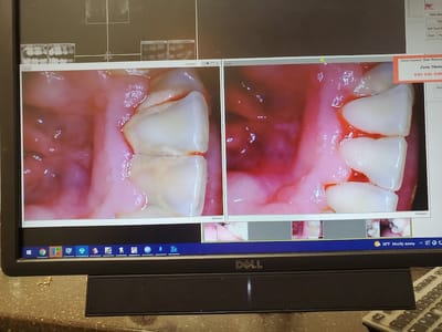 Great Lakes Dental Care