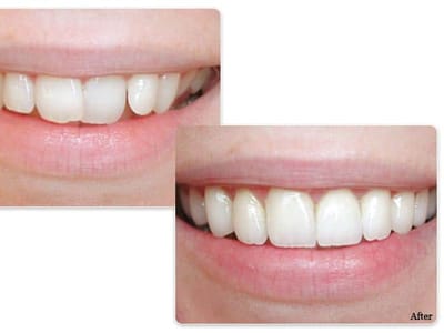 Gregory S. Liss, DDS - Little Falls Dentist