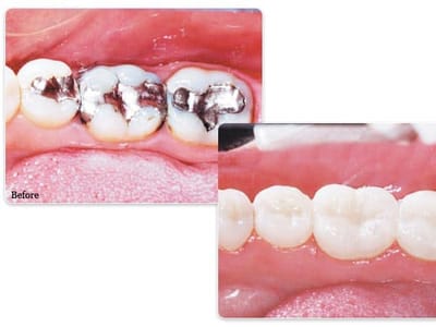 Gregory S. Liss, DDS - Little Falls Dentist