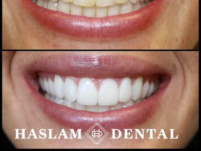 Haslam Dental - Dentist Ogden