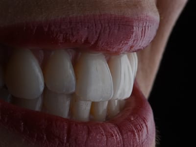 Healthy Smiles Dental - Las Vegas Dentist