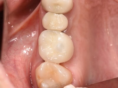 Healthy Smiles Dental - Las Vegas Dentist