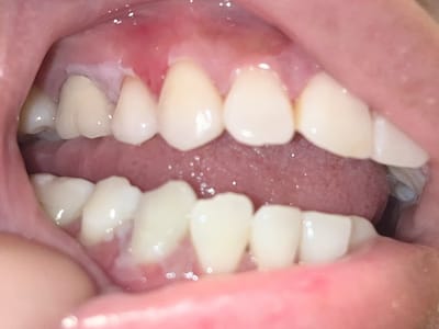 Healthy Smiles Premier Dental