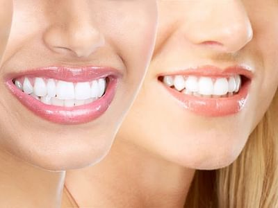 Healthy Teeth Family Dentistry