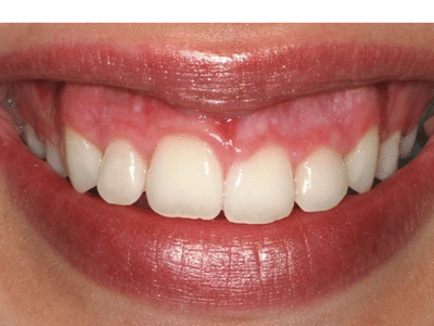 Heringer Dentistry LLC