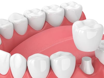 Highland Heights Dental