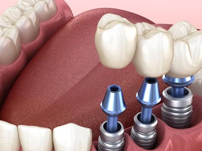 Highland Heights Dental