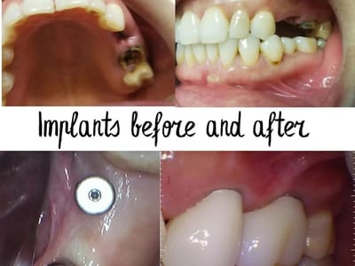 Hills Dental Group - Dentist in San Jose - Family and Cosmetic Dentistry - Dental Clinic in Bay Area