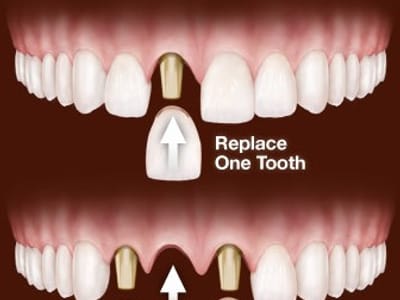 Hughes Dental Arts Centre